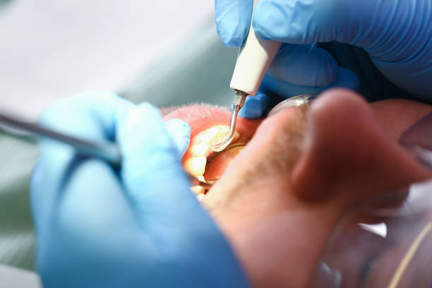 Best Broken or Cracked Tooth Emergency Dentist in Warsaw, IN