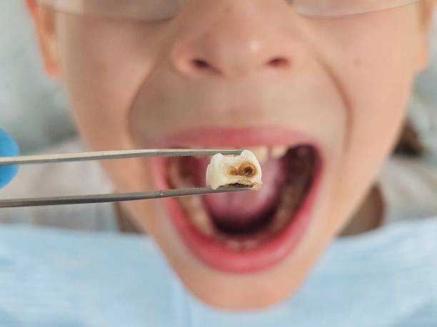 Best Orthodontic Emergency Dentist in Warsaw, IN