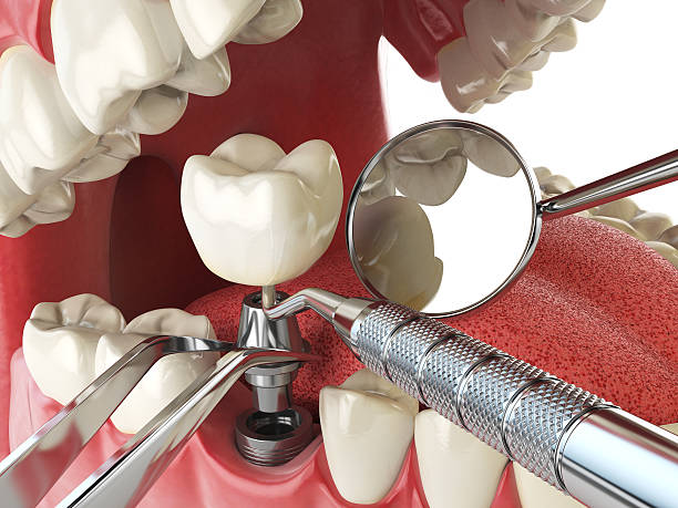 Best Emergency Cosmetic Dentistry in Warsaw, IN